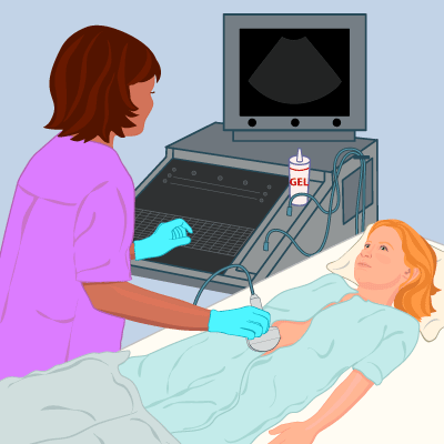 pelvic_ultrasound