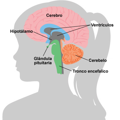 Resonancia magnetica cerebro