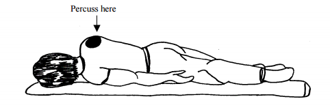 Chest physiotherapy age 2 and older