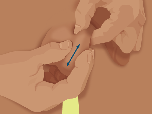 Con la mano libre, desliza el pulgar y los demás dedos por ambos lados del testículo, de arriba a abajo. Pálpalo para notar posibles bultos o protuberanciasLuego desliza los dedos por la parte delantera y trasera del testículo.En la parte trasera superior, deberías notar el epidídimo, un conducto que transporta el esperma. Se trata de un bulto normal y puede ser sensible al tacto.