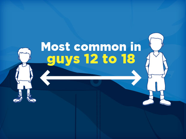 Testicular torsion can happen to guys of any age, but it's most common in teens.Most of the time there's no obvious cause. Testicular torsion can happen after an injury, during exercise, or even during sleep.