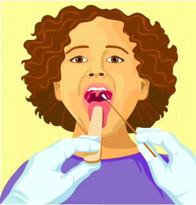 Throat Swab Illustration