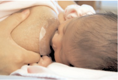 Breastfeeding: When Should You Use A Nipple Shield?